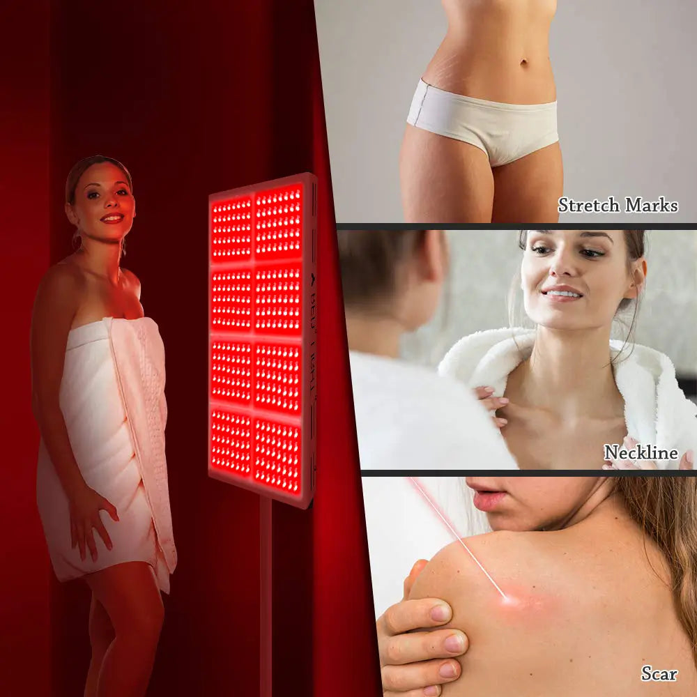 YouLumi IRP010-08T red light therapy panel for stretch marks, neckline rejuvenation, and scar healing