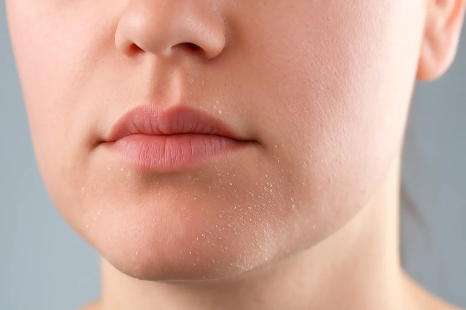 A close-up image showing the common texture of dry skin, such as flakiness and tightness, which are primary reasons people seek treatments like red light therapy for dry skin.