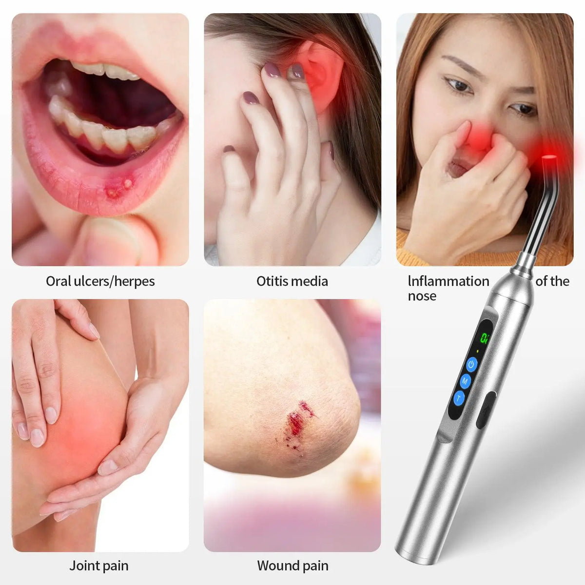 Youlumi red light therapy device for oral ulcers, ear pain, joint pain and wound care