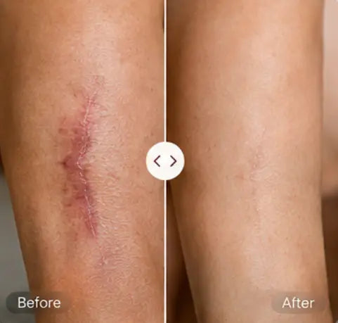 Before and After Results