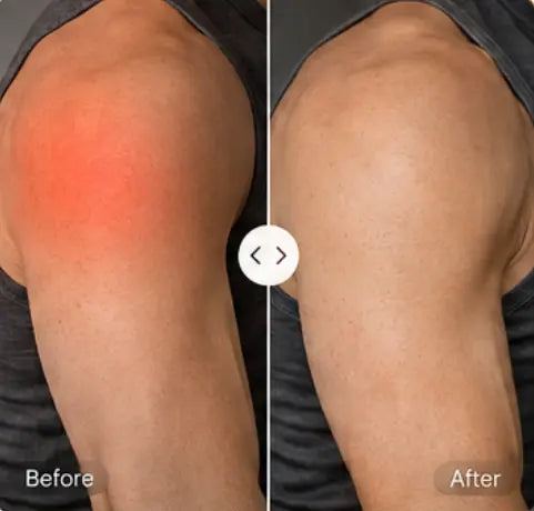 Before and After Results