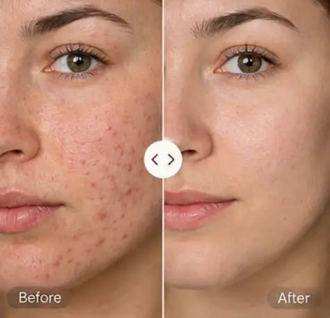 Before and After Results